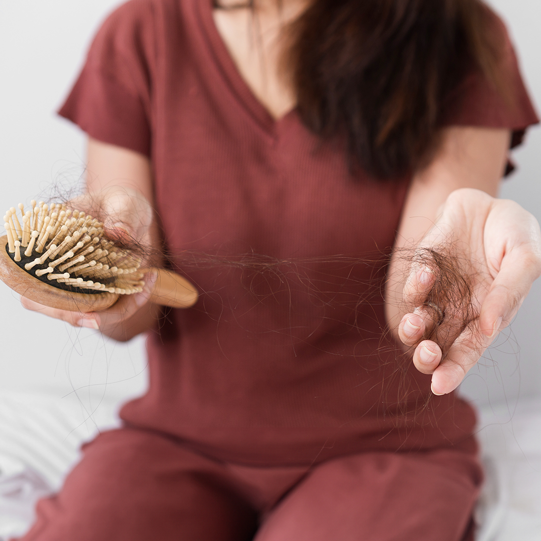 Caduta Capelli Donne Cause E Rimedi Alopecia Androgenetica Femminile